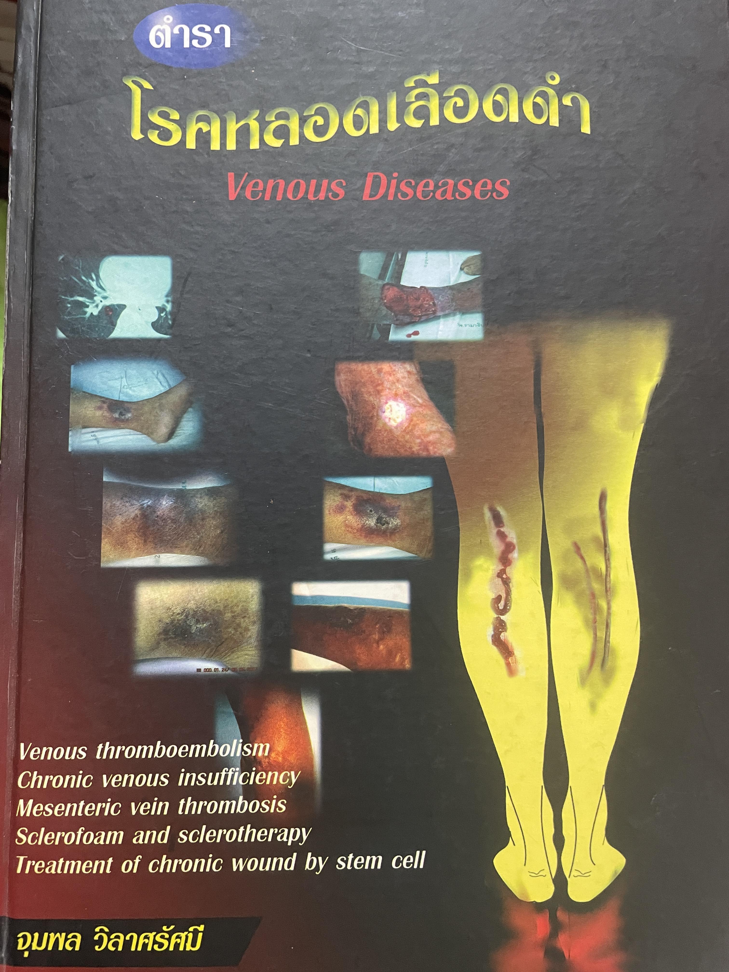 ตำรา โรคหลอดเลือดดำ Venous Diseases ผู้นิพนธ์ จุมพล วิลาศรัศมี 3 กก.