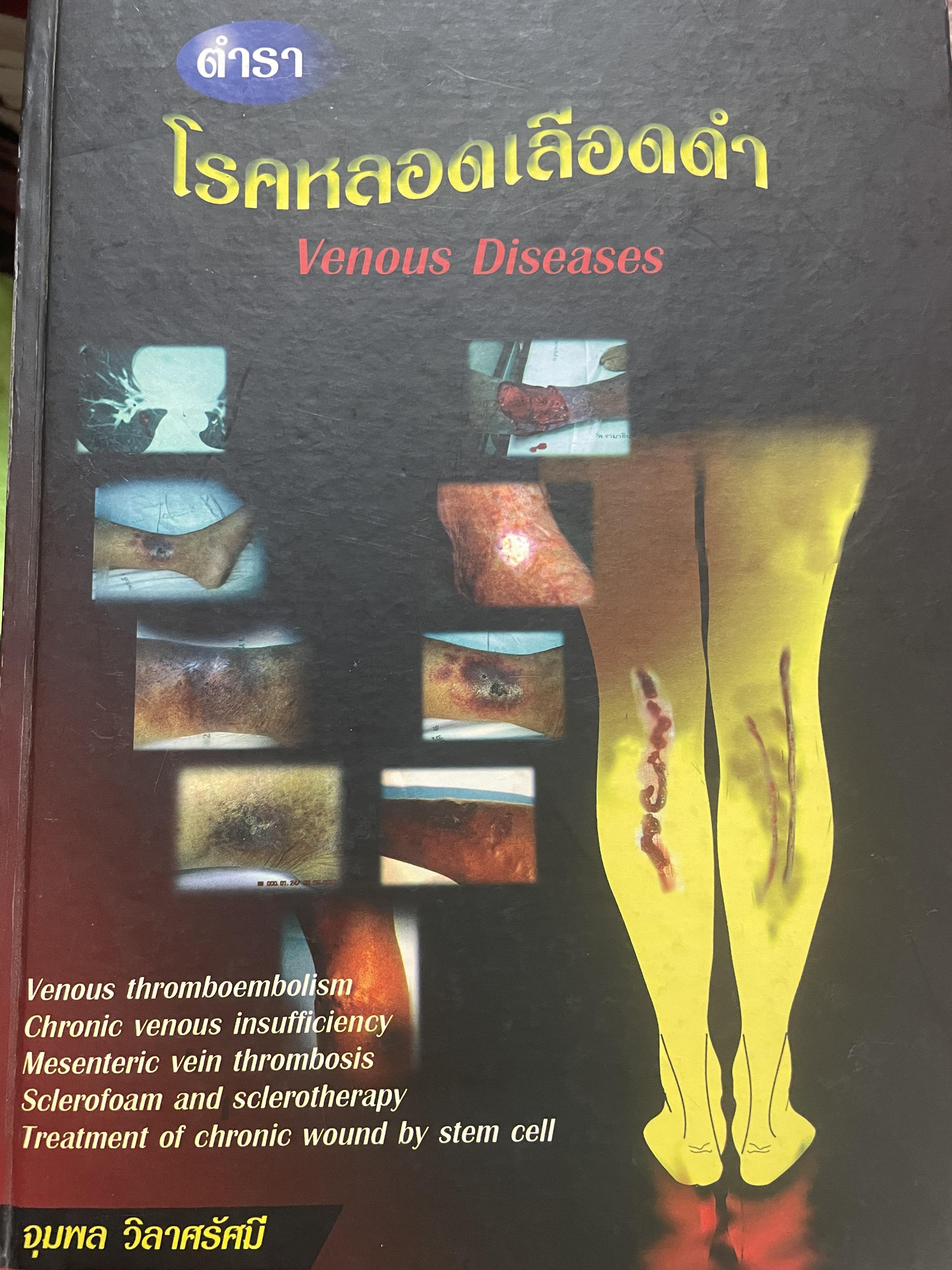 ตำรา โรคหลอดเลือดดำ Venous Diseases ผู้นิพนธ์ จุมพล วิลาศรัศมี 3 กก.