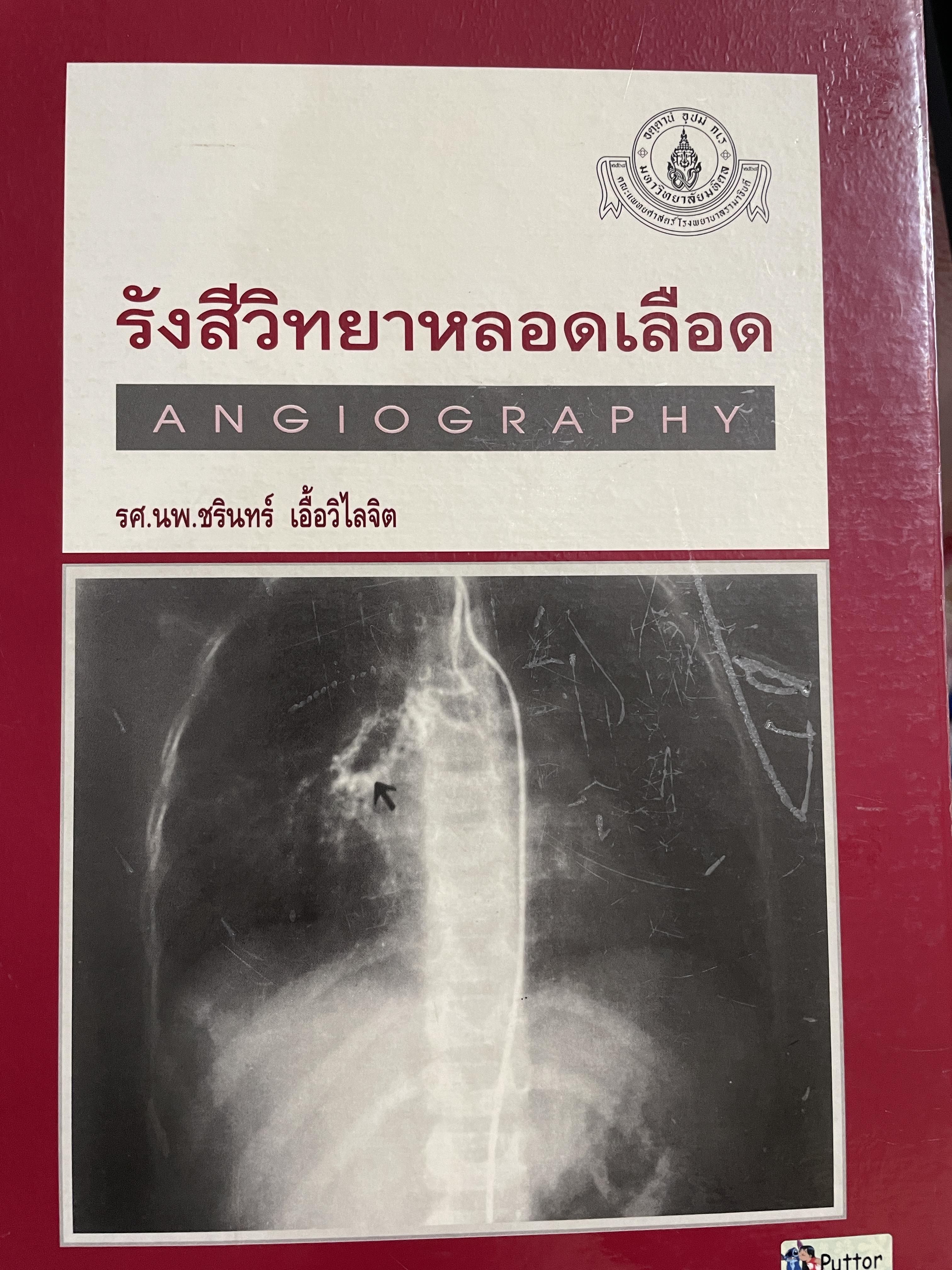 รังสีวิทยาหลอดเลือด ANGIOGRAPHY โดย รศ. นพ. ชริทร์ เอื้อวิไลจิต 3,500 กรัม
