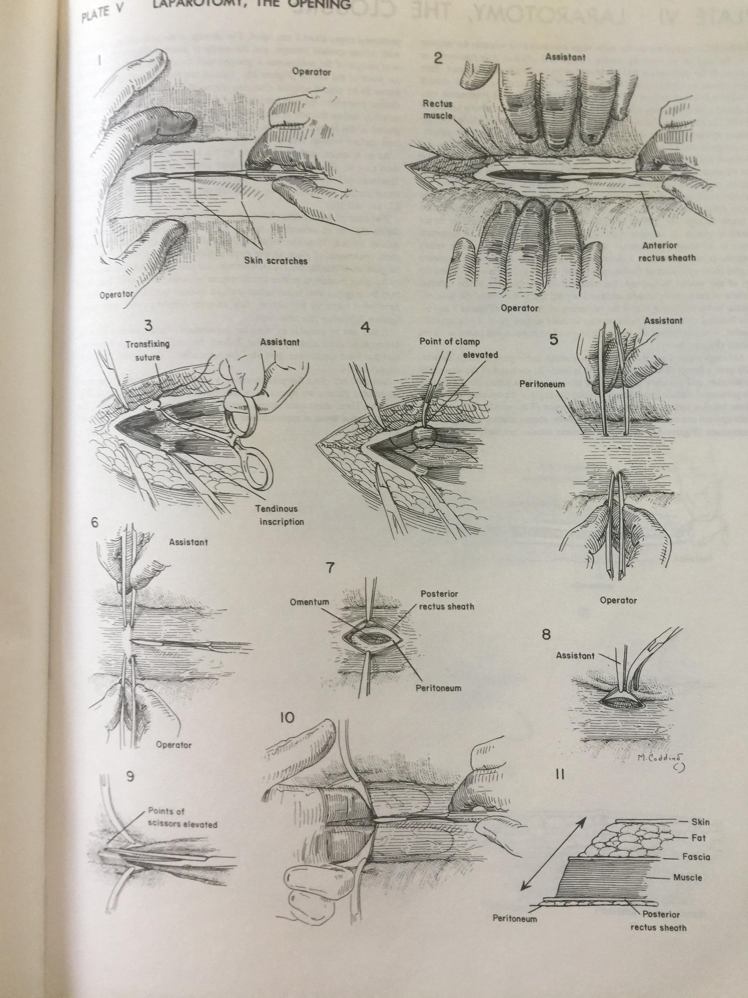 ATLAS OF SURGICAL OPERATIONS. ผู้เขียน ZOLLINGER / ZOLLINGER 0 กก.