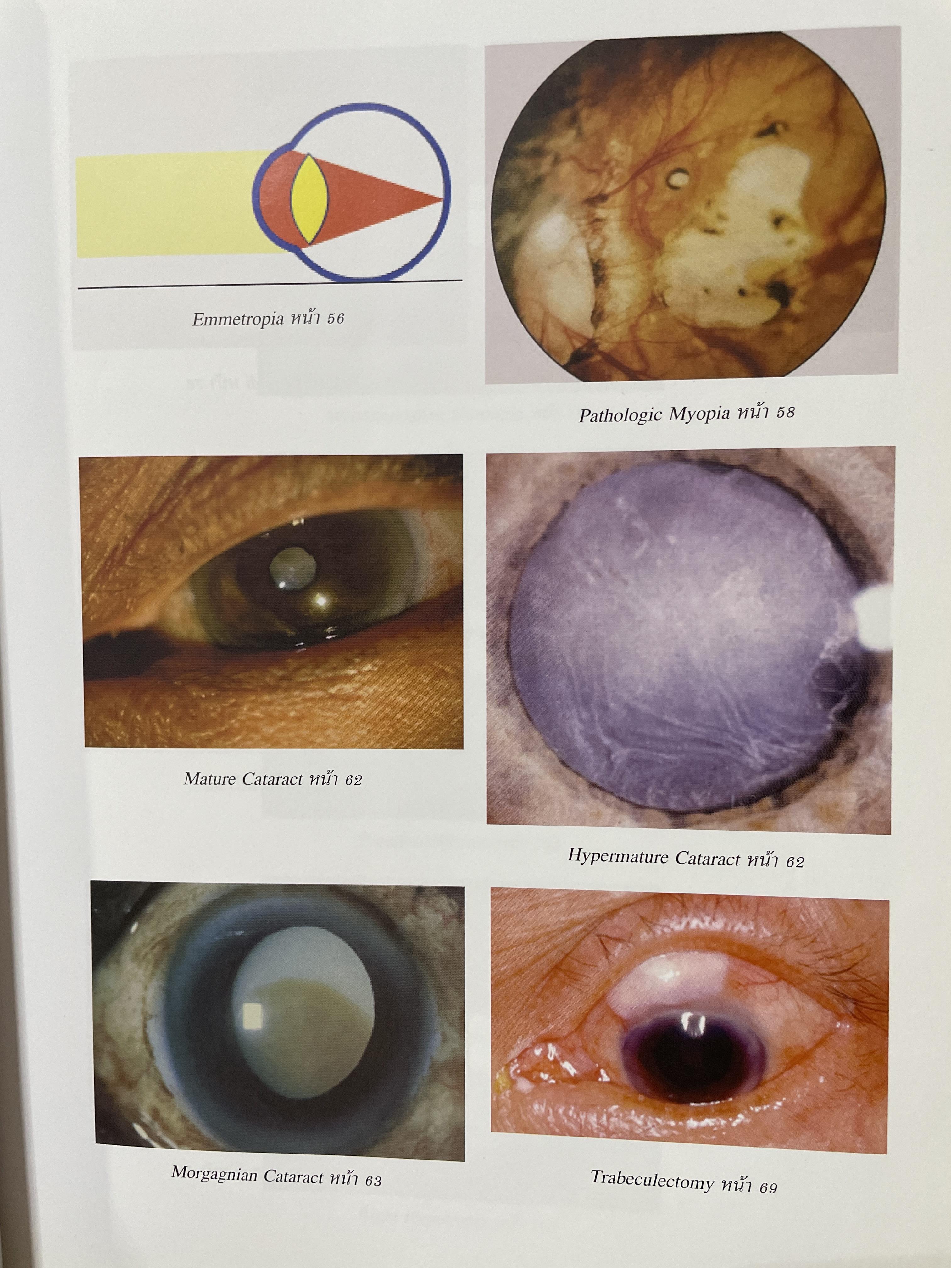 ตำราจักษุวิทยา จัดทำโดย สาขาจักษุวิทยา คณะแพทยศาสตร์ มหาวิทยาลัยธรรมศาสตรฺ์ 2,500 กรัม