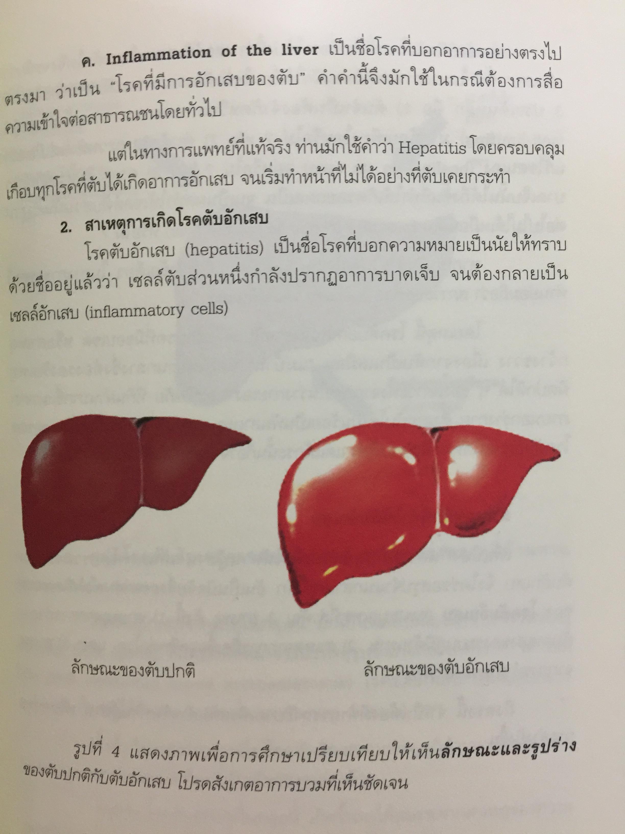 คู่มือแปลผลตรวจเลือด ไวรัสลงตับ. เพื่อหยั่งรู้ปัจจัยเสี่ยง(ลดโอกาสเกิด) โรคมะเร็งตับ 3,500 กรัม
