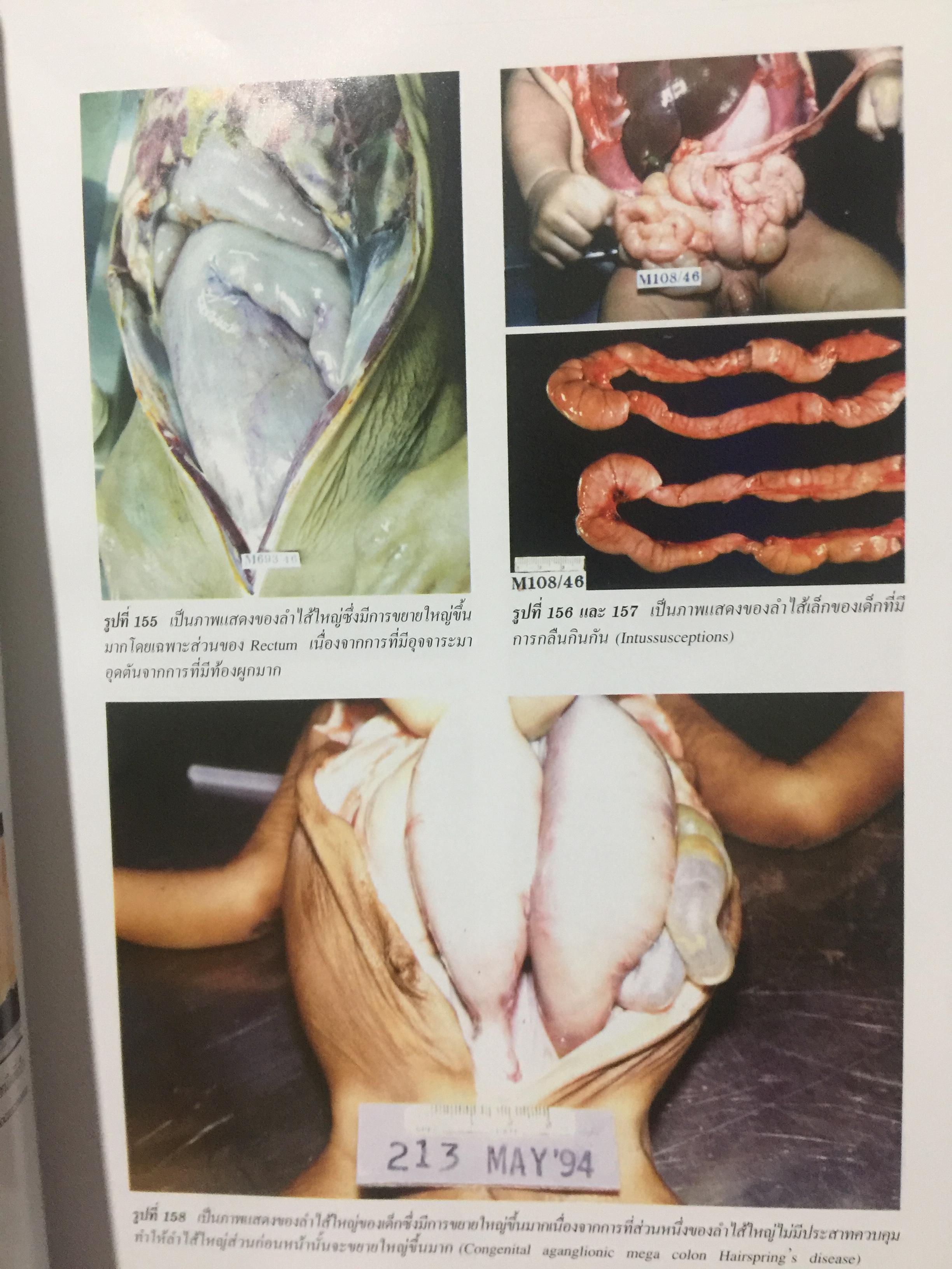 ตายฉับพลัน จากโรคที่คาดไม่ถึง. Color atlas of sudden unexpected natural death. ผู้เขียน รองศาสตราจารย์ นายแพทย์ธำรง จิรจริยาเวช. 1 กก.