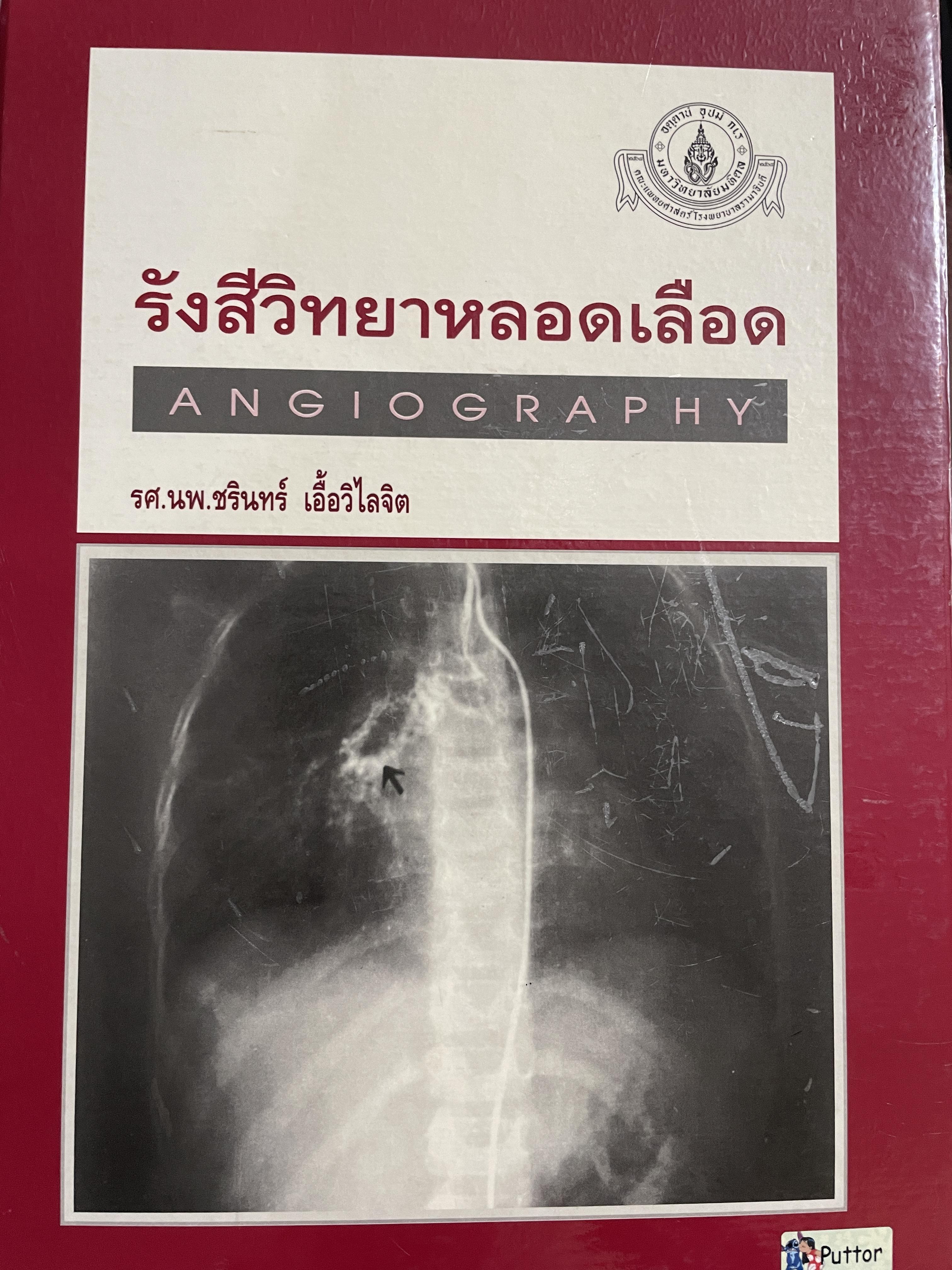 รังสีวิทยาหลอดเลือด ANGIOGRAPHY โดย รศ. นพ. ชริทร์ เอื้อวิไลจิต 3,500 กรัม