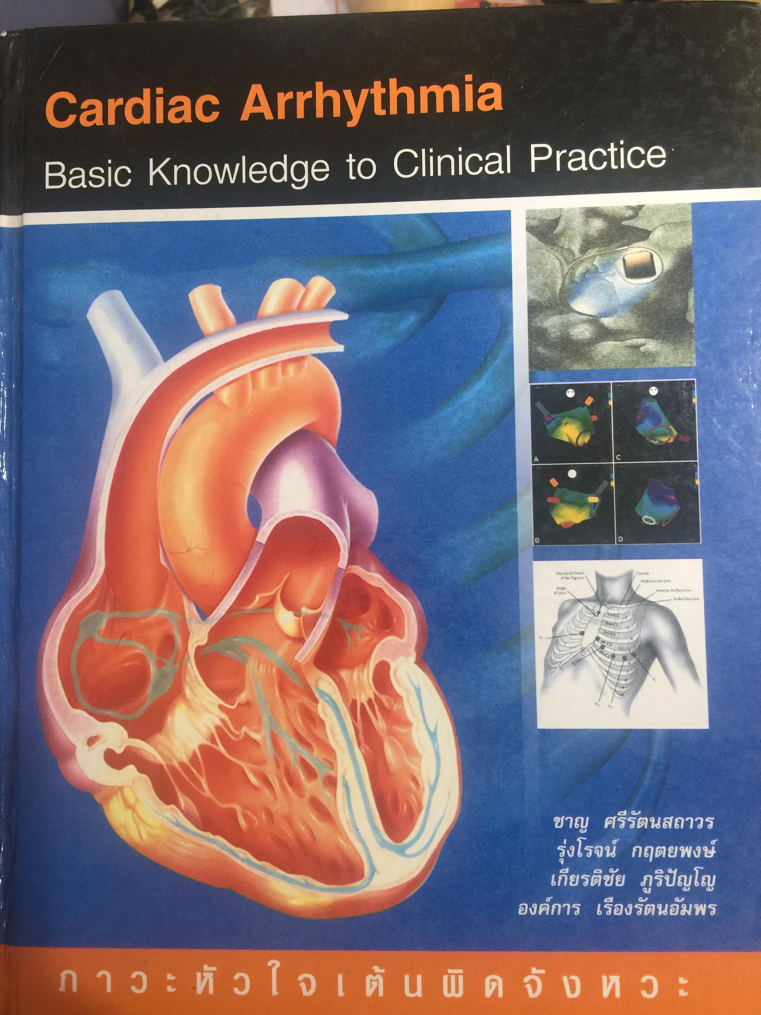 ภาวะหัวใจเต้นผิดจังหวะ. Cardiac Arrhythmia. basic Knowledge to Clinical Practice ผู้เขียน ขาณุ ศรีรัตนสถาวรและคณะ 0 กก.