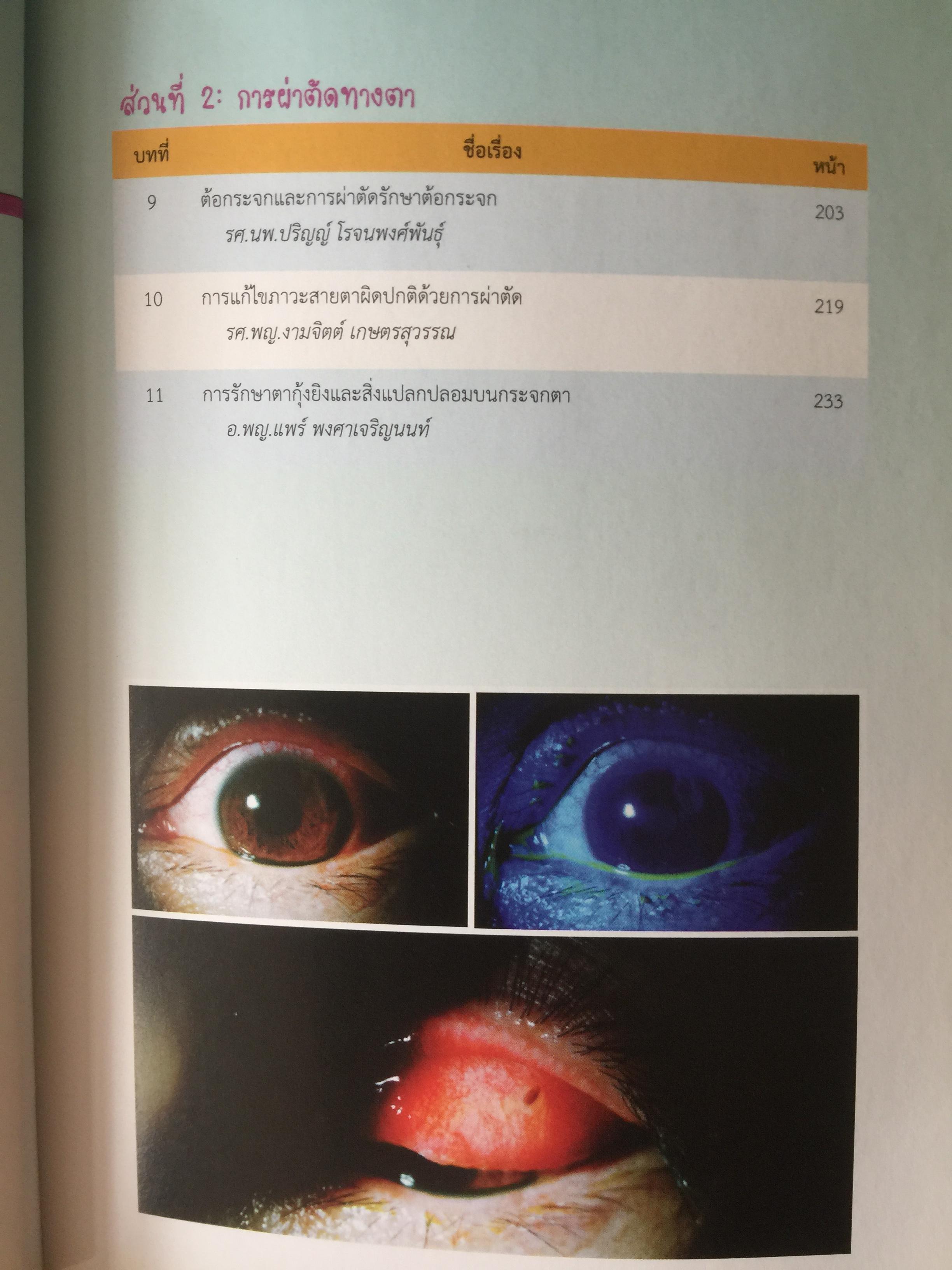 จักษุจุฬา. CHULA. EYE. BOOK สำหรับแพทย์ทั่วไป นิสิตนักศึกษาแพทย์ พยาบาล เจ้าหน้าที่ทางสาธารณสุขและบุคคลทั่วไปที่สนใจในโรคทางตา จัดทำโดย ภาควิชาจักษุวิทยา คณะแพทยศาสตร์ จุฬาลงกรณ์มหาวิทยาลัย 3 กก.