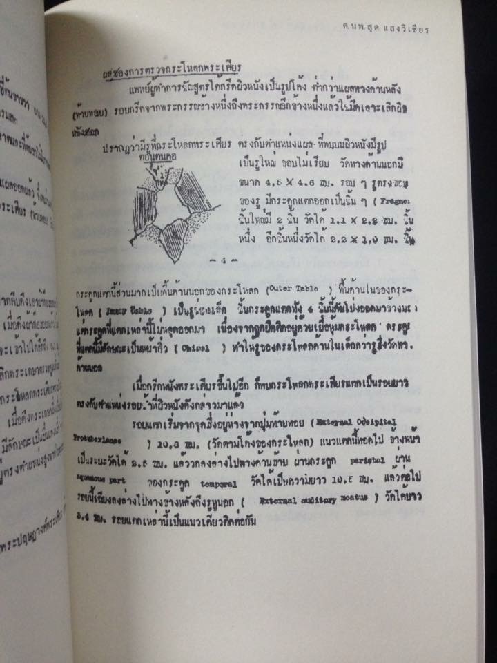 เมื่อข้าพเจ้าเข้าไปเกี่ยวข้องกับกรณีสวรรคต