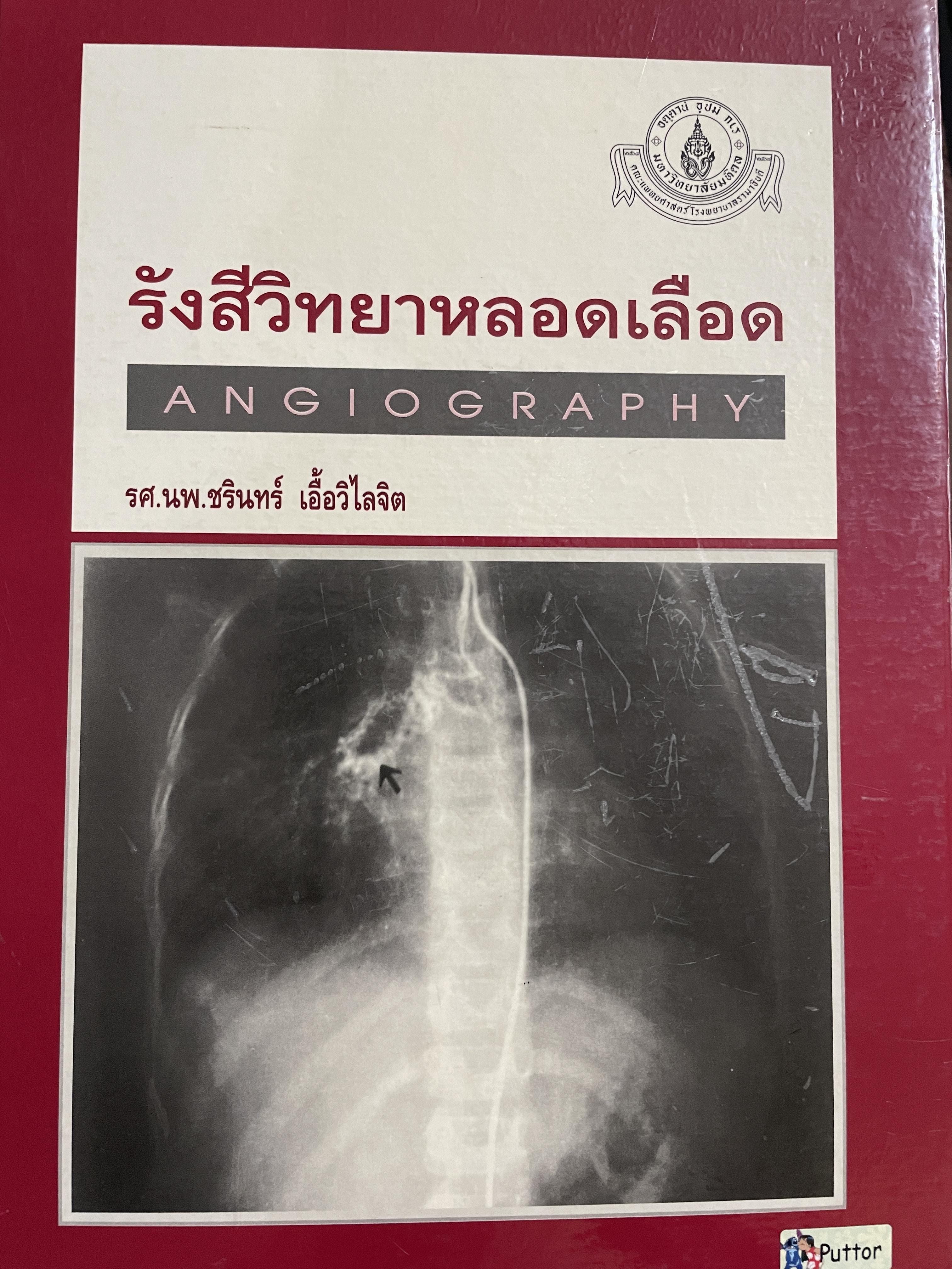 รังสีวิทยาหลอดเลือด ANGIOGRAPHY โดย รศ. นพ. ชริทร์ เอื้อวิไลจิต 3,500 กรัม