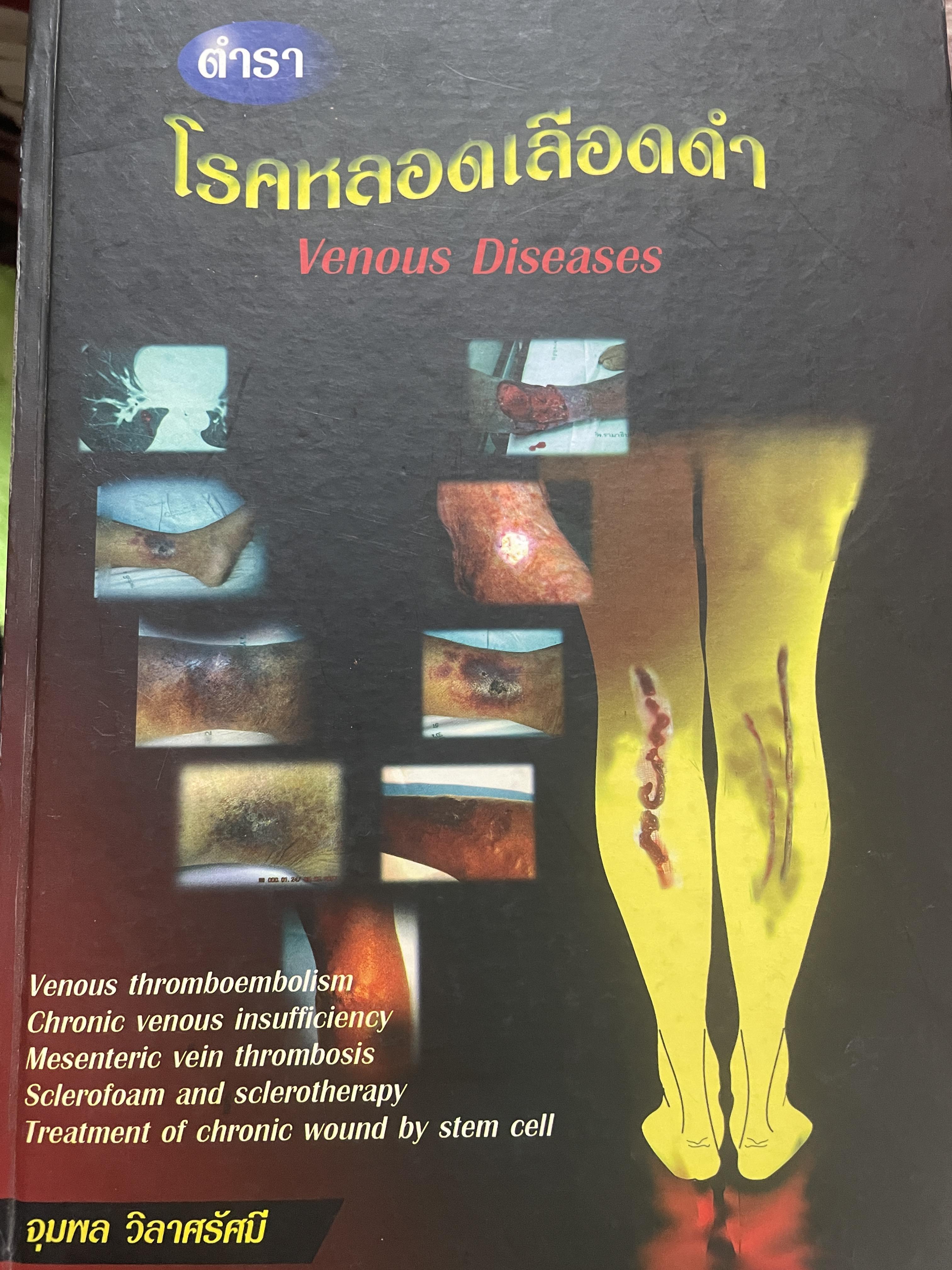 ตำรา โรคหลอดเลือดดำ Venous Diseases ผู้นิพนธ์ จุมพล วิลาศรัศมี 3 กก.