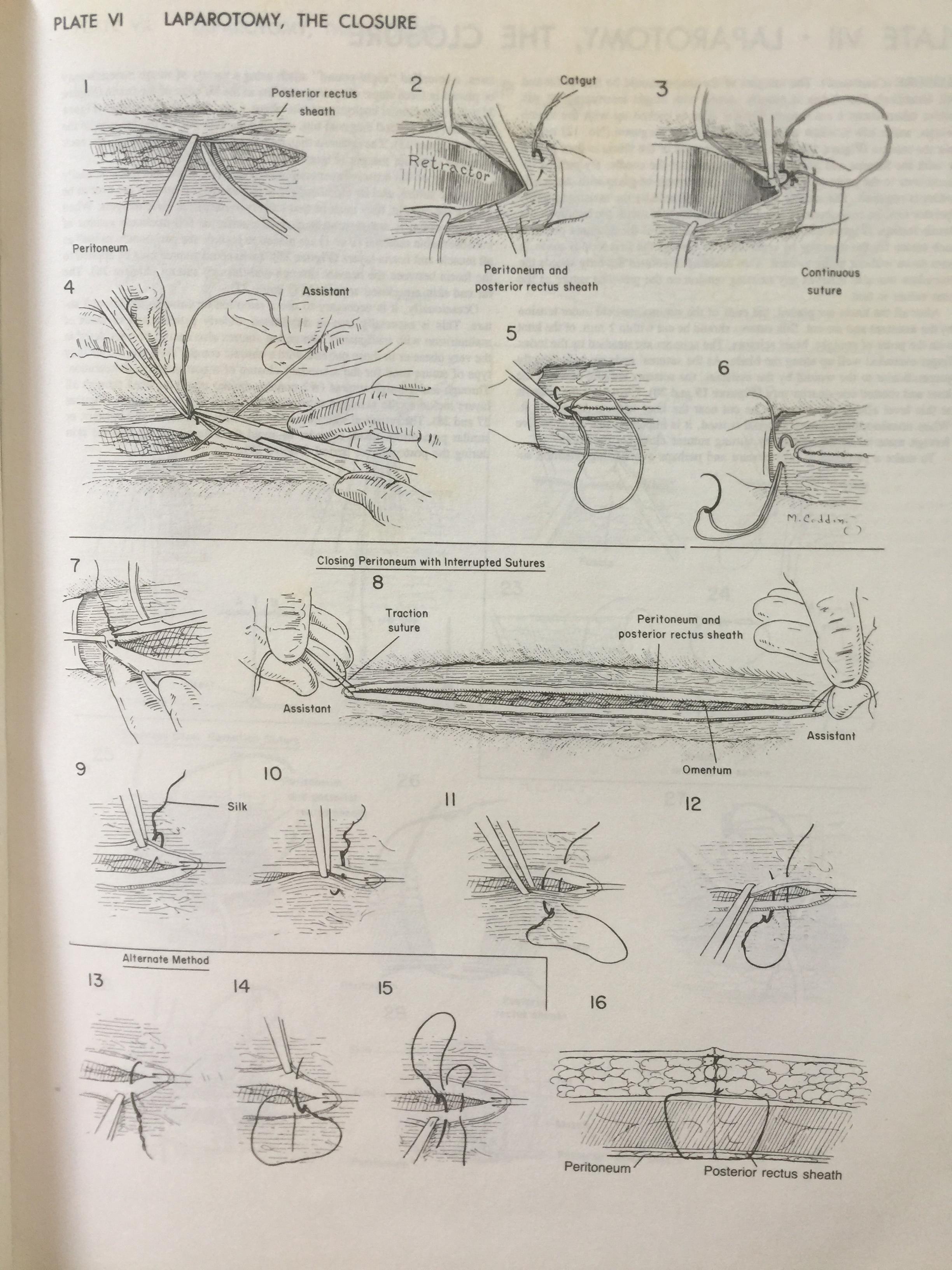 ATLAS OF SURGICAL OPERATIONS. ผู้เขียน ZOLLINGER / ZOLLINGER 0 กก.