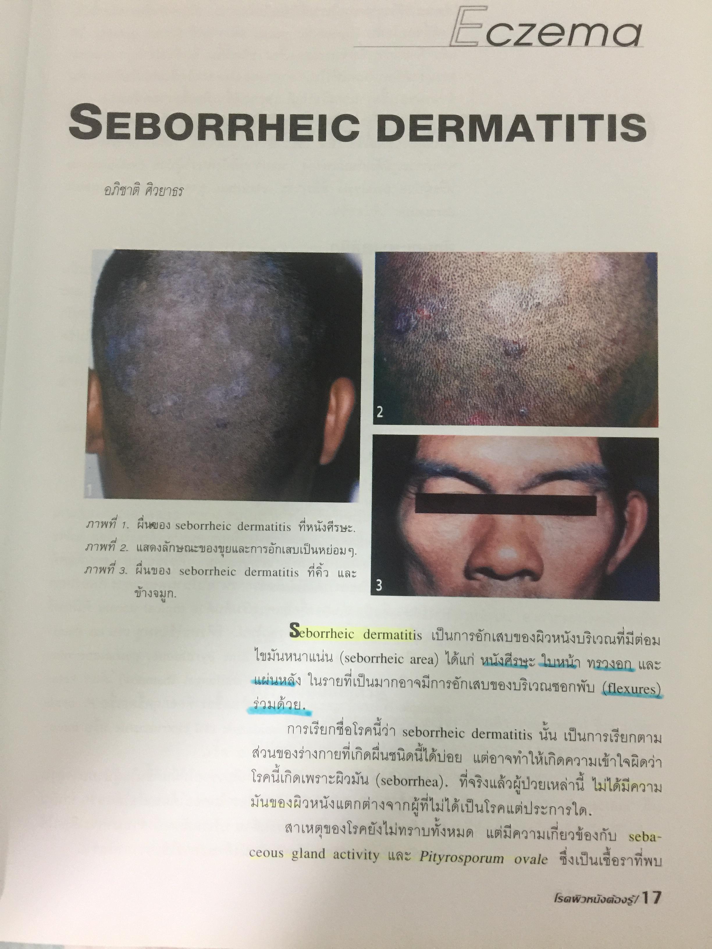 โรคผิวหนังต้องรู้ สำหรับเวชปฎิบัติทั่วไป. ความรู้เรื่องโรคผิวหนังเหมาะสำหรับแพทย์ แพทย์ประจำบ้าน แพทย์เวชปฎิบัติทั่วไป นิสิตนักศึกษาแพทย์และบุคคลการทางแพทย์ที่สนใจ 3,500 กรัม