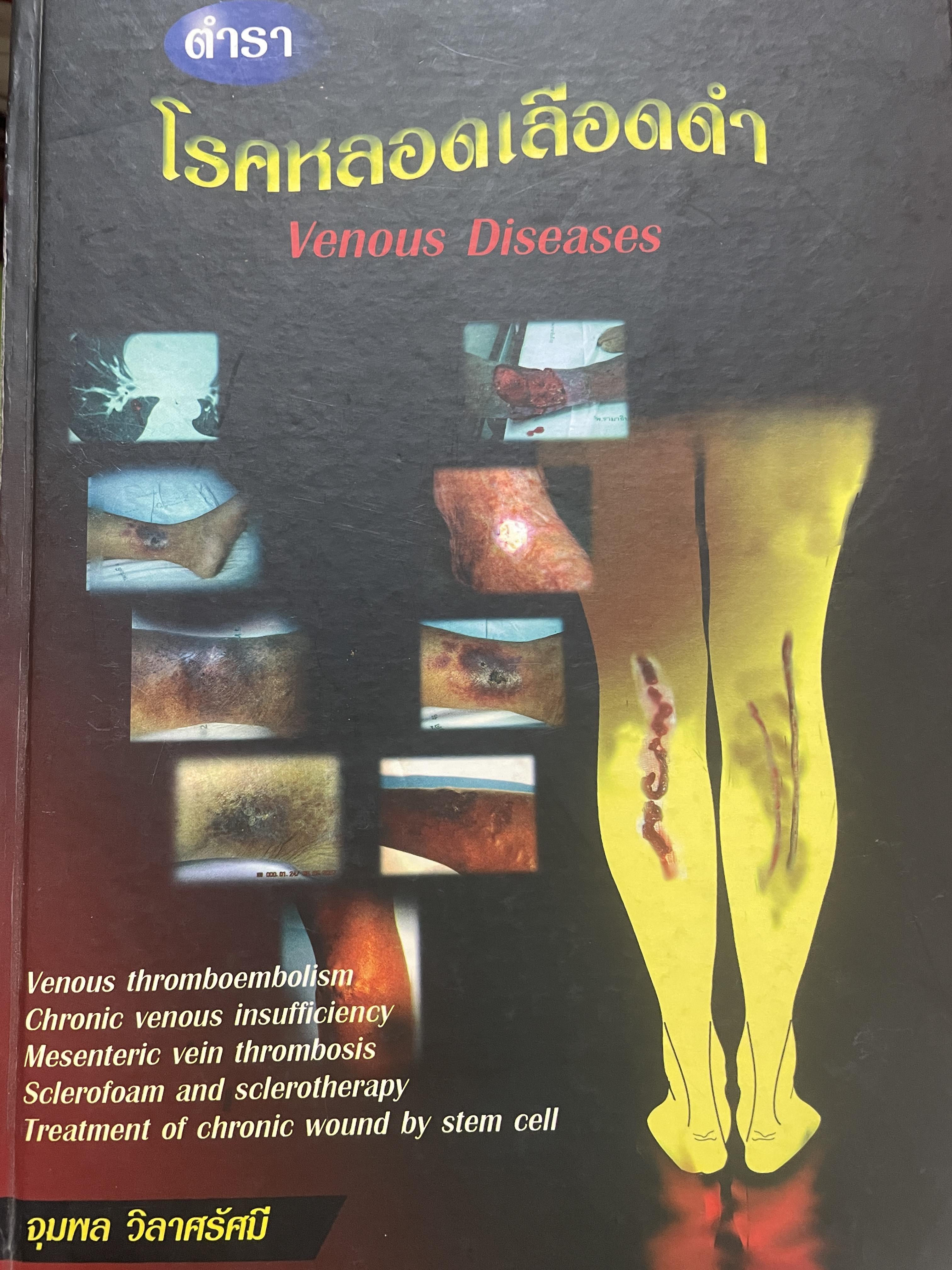 ตำรา โรคหลอดเลือดดำ Venous Diseases ผู้นิพนธ์ จุมพล วิลาศรัศมี 3 กก.