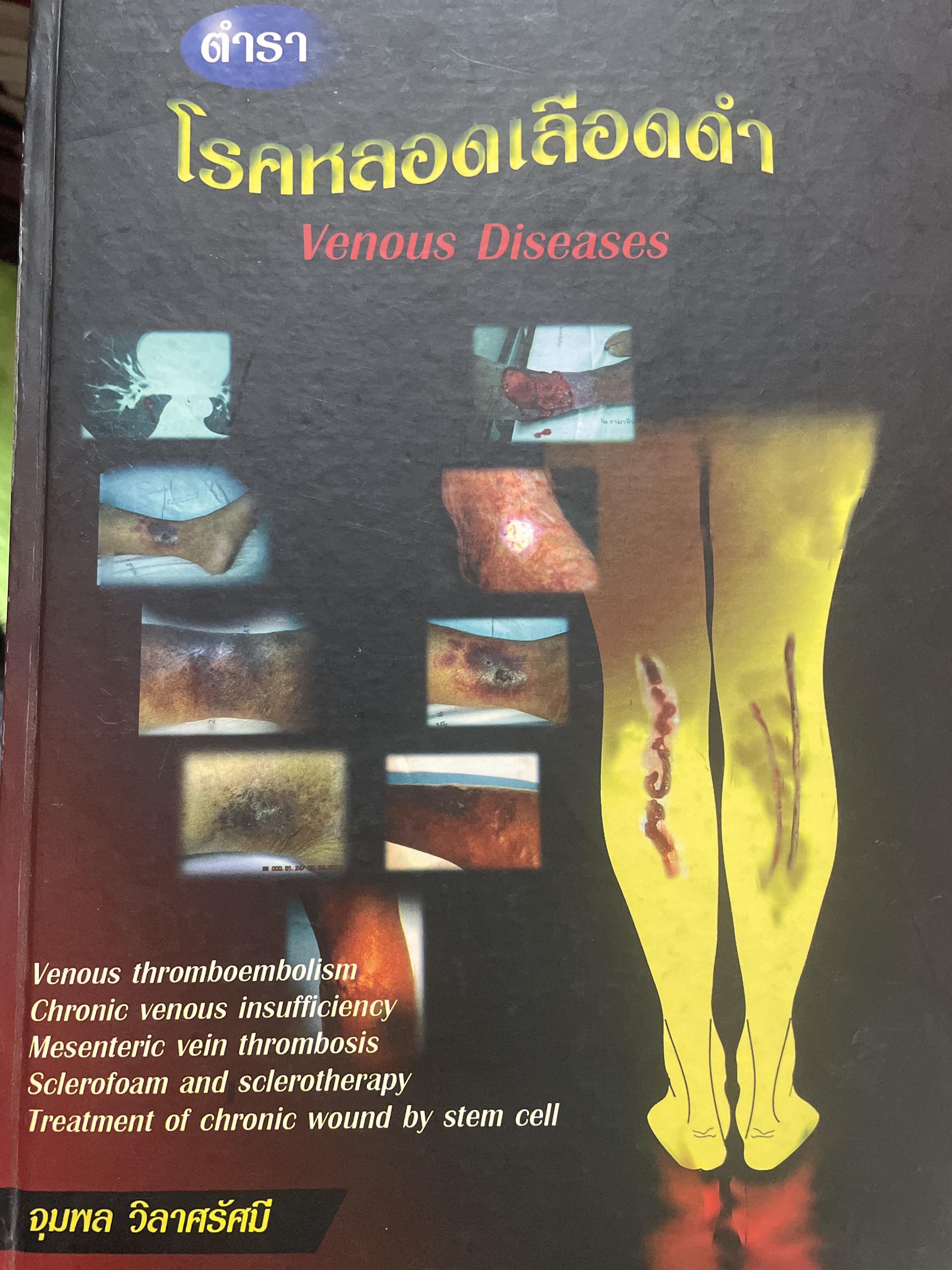 ตำรา โรคหลอดเลือดดำ Venous Diseases ผู้นิพนธ์ จุมพล วิลาศรัศมี 3 กก.