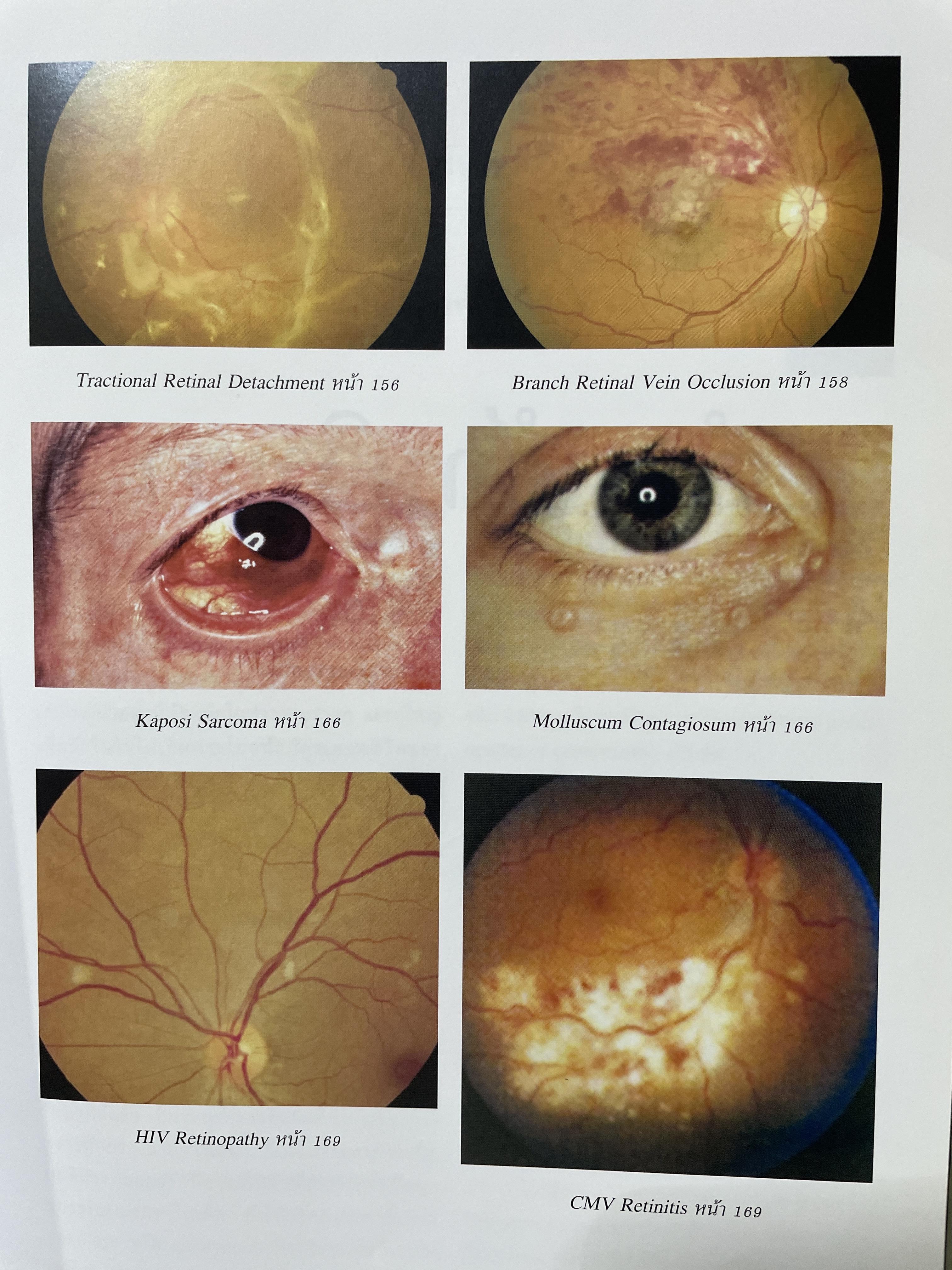 ตำราจักษุวิทยา จัดทำโดย สาขาจักษุวิทยา คณะแพทยศาสตร์ มหาวิทยาลัยธรรมศาสตรฺ์ 2,500 กรัม
