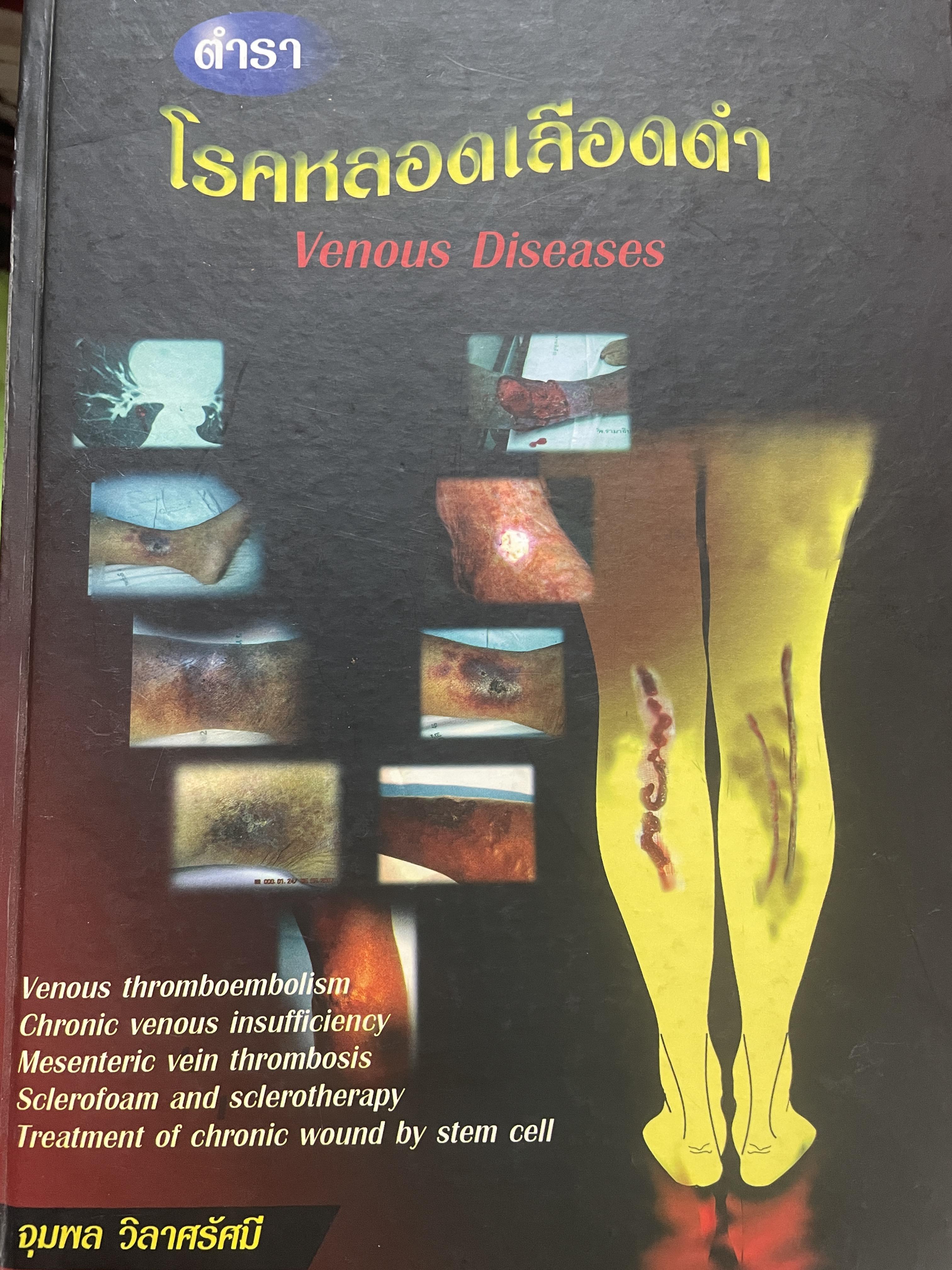 ตำรา โรคหลอดเลือดดำ Venous Diseases ผู้นิพนธ์ จุมพล วิลาศรัศมี 3 กก.