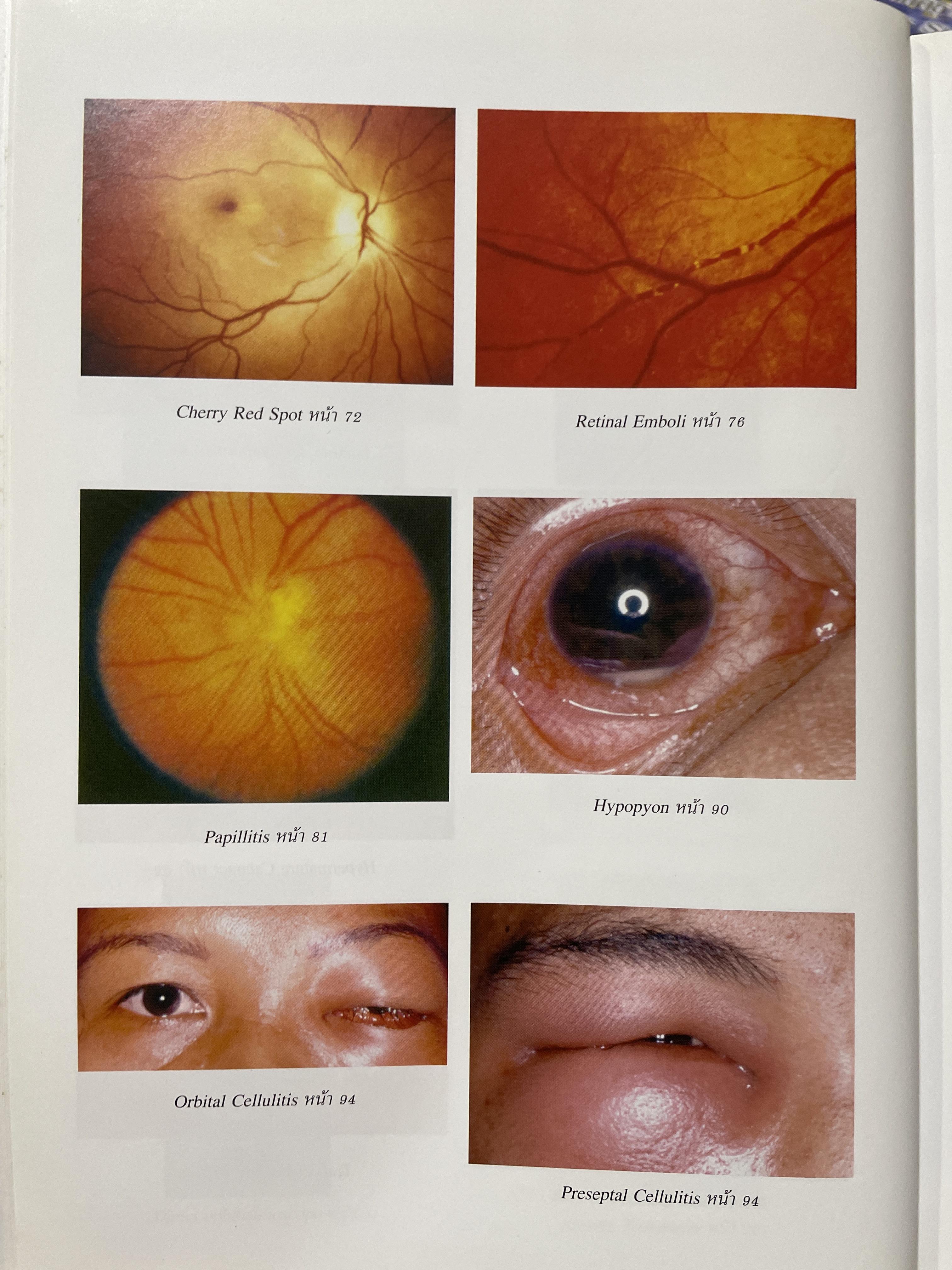 ตำราจักษุวิทยา จัดทำโดย สาขาจักษุวิทยา คณะแพทยศาสตร์ มหาวิทยาลัยธรรมศาสตรฺ์ 2,500 กรัม