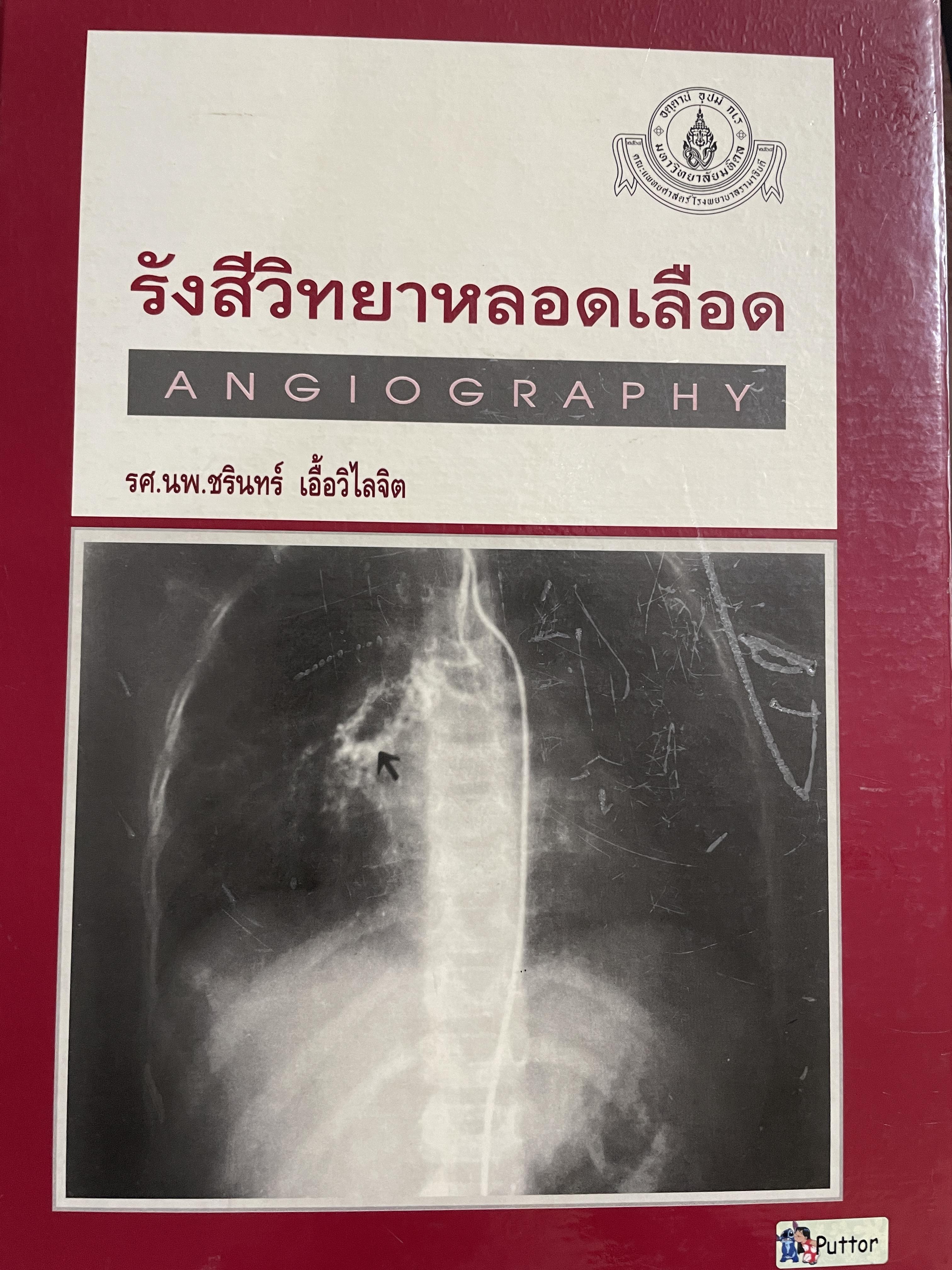 รังสีวิทยาหลอดเลือด ANGIOGRAPHY โดย รศ. นพ. ชริทร์ เอื้อวิไลจิต 3,500 กรัม
