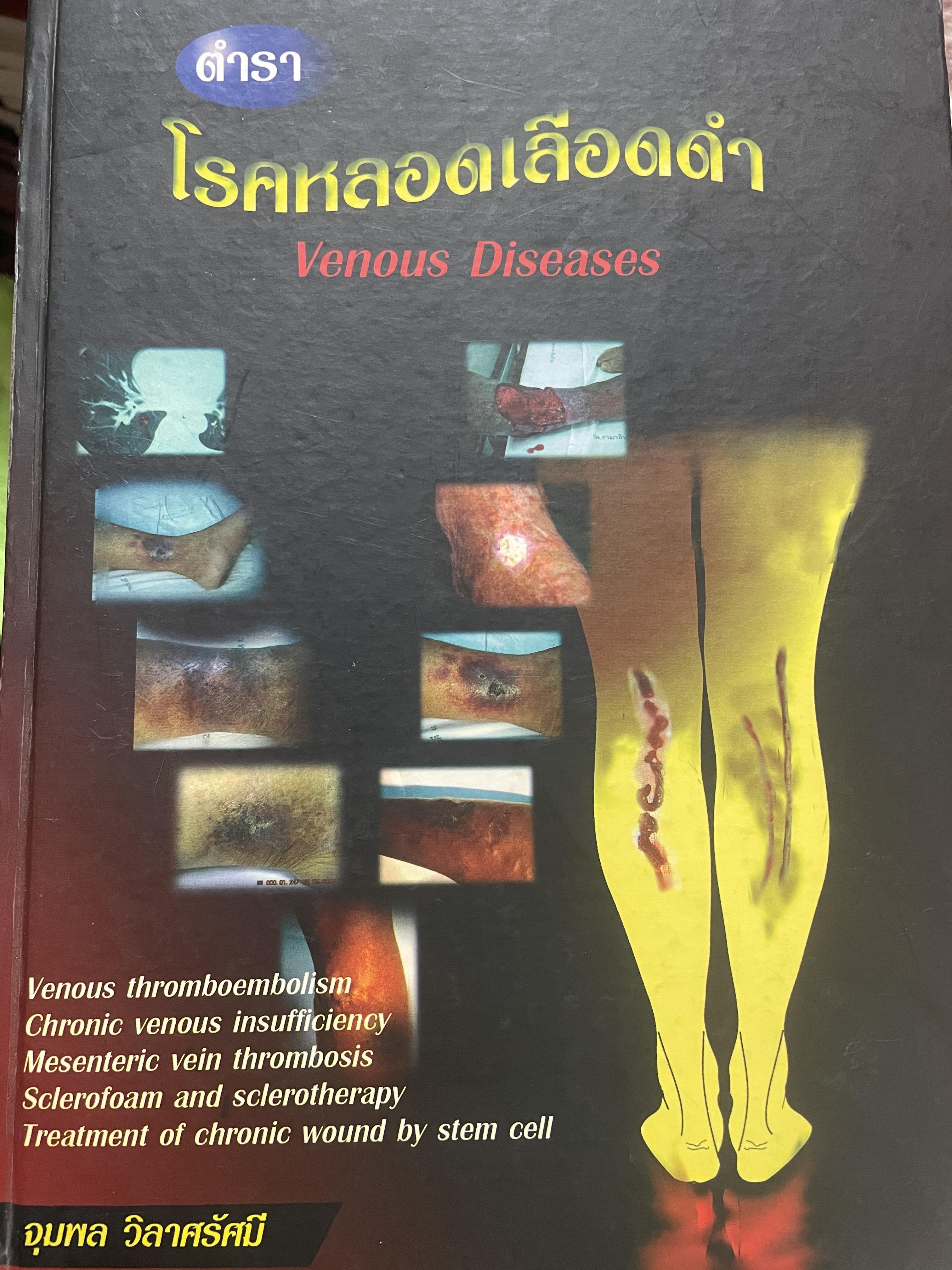 ตำรา โรคหลอดเลือดดำ Venous Diseases ผู้นิพนธ์ จุมพล วิลาศรัศมี 3 กก.