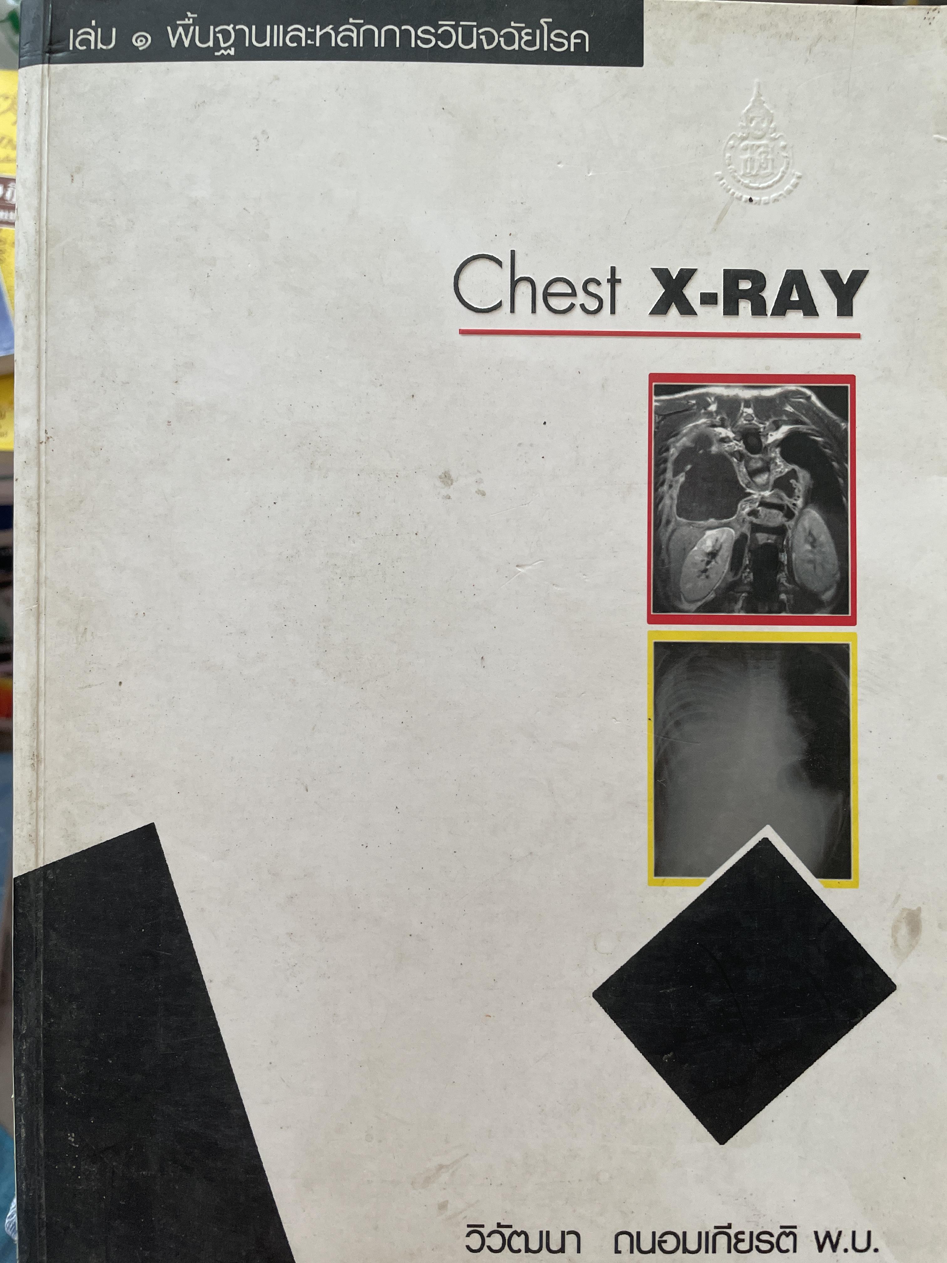Chest X-RAY. เล่ม 1 พื้นฐานและหลักการวินิจฉัยโรค ผู้เขียน วิวัฒนา ถนอมเกียรติ พ.ม. 3,500 กรัม